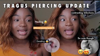 TRAGUS PIERCING EXPERIENCE  PRICE PAIN AFTERCARE amp MORE 2 year update [upl. by Khajeh954]