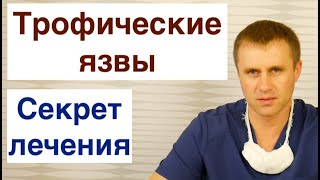 Трофические язвы Секрет лечения [upl. by Dahcir]