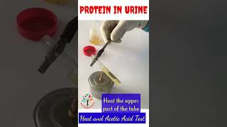 Protein in Urine ll Heat and Acetic acid test ll shorts [upl. by Puritan]