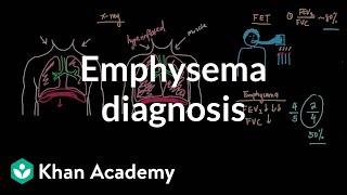 Emphysema diagnosis  Respiratory system diseases  NCLEXRN  Khan Academy [upl. by Caine]