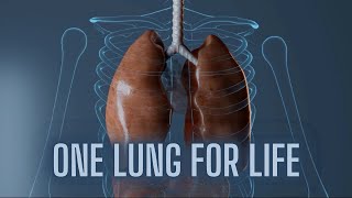 Living with One Lung What to Expect [upl. by Atram]