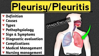 PleurisyPleuritis lecture in Hindi and English medical nursingcriteria pleuritis paramedical [upl. by Joletta]