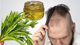 SuperRezept für Haare mit Rosmarin🌿 Selbst auf einer Glatze wachsen Haare💯 Von Haarausfall [upl. by Basilio]