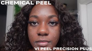 VI Precision Plus Chemical Peel  7 day peel process Chemical peel on Dark Skin [upl. by Kennett739]