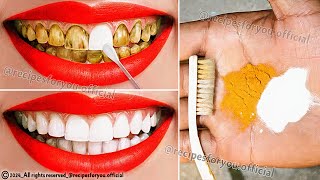 Natural mixtures for yellow teeth whitening at home in 2 minutes without a dentist a proven method💯 [upl. by Egidius]