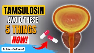 Taking Tamsulosin 5 Things You Must Avoid If You Are Taking Tamsulosin [upl. by Eelir]