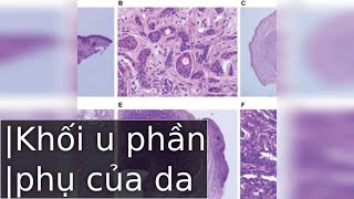 Tầm Quan Trọng Của Phát Hiện Sớm [upl. by Olodort789]