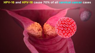 Human Papillomavirus HPV [upl. by Newol]