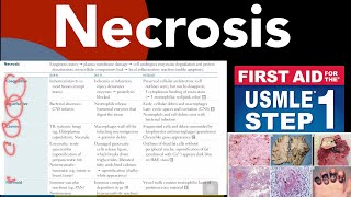 Necrosis Coaglative Liquefactive Caseous Fat Fibrinoid necrosis in HindiUrdu by first aid [upl. by Lahsram]