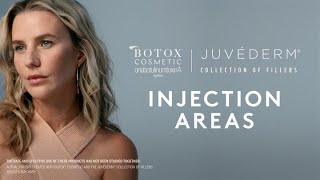 Injection Areas 101  What areas do BOTOX® Cosmetic or JUVÉDERM® Fillers treat [upl. by Marijane44]