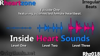 Rhz018 Rheartzone  Inside Heart Sounds 01 Irregular female heartbeat [upl. by Rimhsak]