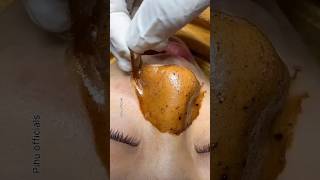 Remove Blackheads amp Whiteheads Permanently At Home  Get Rid Of Blackheads shorts viralvideo diy [upl. by Kendrick]