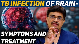 TB Infection of Brain Symptoms and Treatment DrRoopesh Kumar [upl. by Cirilo]