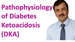 Diabetes Ketoacidosis DKA  Pathophysiology [upl. by Eugenides]