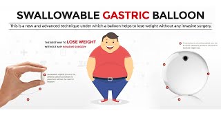 Swallowable Gastric Balloon Elipse Allurion Balloon Pill Side Effects Reviews Cost in India [upl. by Wobniar]