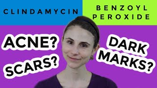 Clindamycin versus benzoyl peroxide for acne Dr Dray [upl. by Haik607]