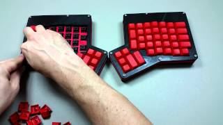 How to Build an Ergodox Assembly 11 [upl. by Gebhardt276]