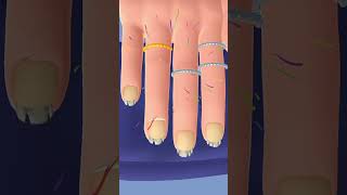 Finger amp nail treatment  nail treatment  nailtreatmentfingertreatment [upl. by Keri]