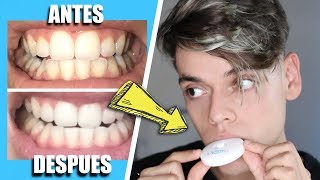 CÓMO BLANQUEAR tus dientes en MINUTOS  BLANQUEADOR DENTAL con LUZ 😬 ¿FUNCIONA [upl. by Airlee120]