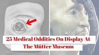 25 Medical Oddities On Display At The Mütter Museum [upl. by Adnuhs336]