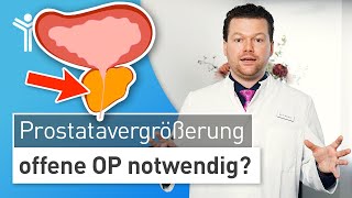 Prostatavergrößerung Prostata zu groß für minimalinvasive OP [upl. by Eceertal735]