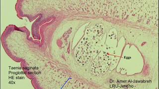 Taenia saginata proglottid cross section [upl. by Krissie3]