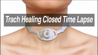 Tracheostomy Healing Closed Time Lapse [upl. by Pinchas]