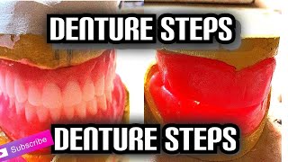 Denture Steps Bite Blocks and Bite Registration [upl. by Retsel]