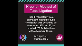 Kroener Fimbriectomy Method of Tubal Ligation [upl. by Nosirb]