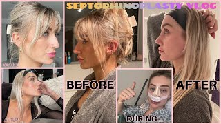 NOSE JOB Vlog Going To Turkey For a Septorhinoplasty 😱 [upl. by Kern]