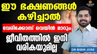 ഈ ഭക്ഷണങ്ങൾ കഴിച്ചു വെരികോസ് വെയ്ൻ പൂർണമായി മാറ്റം Vericose Treatment in Malayalam Dr Bibin Jose [upl. by Coben401]