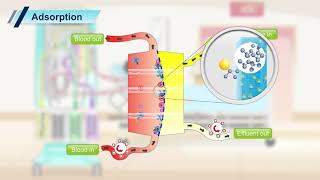 Prismaflex CRRT Transport Mechanism [upl. by Oremodlab231]