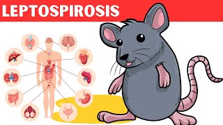 Leptospirosis  Causes Risk Factors Pathology Signs amp Symptoms Diagnosis And Treatment [upl. by Chrissie]