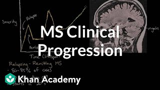 Clinical progression of multiple sclerosis  Nervous system diseases  NCLEXRN  Khan Academy [upl. by Gula995]