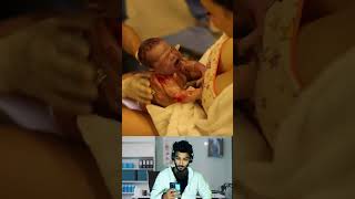 Cute babyjunior birth medico respectdoctors newbornbabyshortfeeds pregnancy [upl. by Un3]