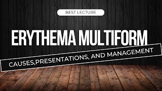 Erythema multiform  Erythema multiform lecture  Oral medicine lecture [upl. by Nylyak]