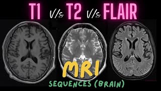 T1 vs T2 vs FLAIR  Difference between basic MRI sequences Mnemonics and basic physics [upl. by Spielman441]