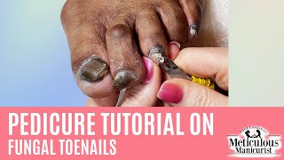 How to Pedicure on Thick Dark Toenails with Nail Fungus [upl. by Akiemehs]