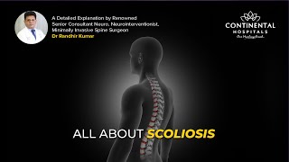 Scoliosis Explained Causes Symptoms amp Treatment Options  Dr Randhir Best Neurosurgeon Hyderabad [upl. by Rede758]