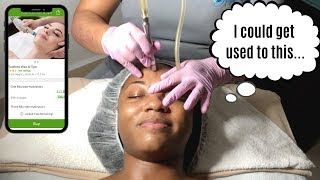 VERY FIRST MICRODERMABRASION FACIAL  Get rid of hyperpigmentation [upl. by Riccio]