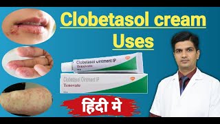 Clobetasol Propionate cream uses  Tenovate cream Uses in hindi [upl. by Aknaib823]