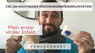 Tag 186 nach meiner Knochenmarktransplantation [upl. by Anaj]