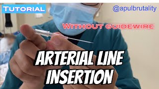 Arterial line insertion without guidewire  tutorial [upl. by Leirej966]