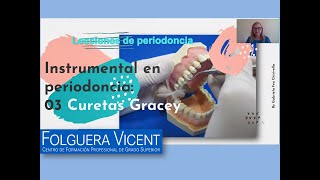 Lecciones de periodoncia Nº3 Curetas Gracey [upl. by Enert]