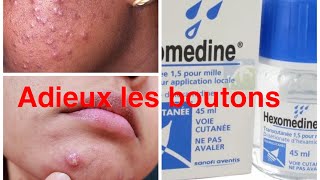 HEXOMEDINE la solution miracle pour combattre les boutons sur le visage 🔥🔥 [upl. by Salina]