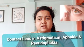 Contact Lens in Astigmatism Aphakia amp Pseudophakia [upl. by Carri807]