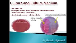 Bacteriology Culture Types of culture medium and their uses [upl. by Bubb877]