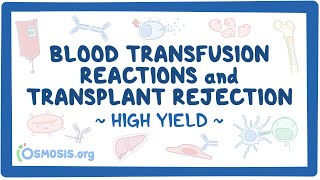 Blood transfusion reactions and transplant rejection Pathology Review [upl. by Katine]