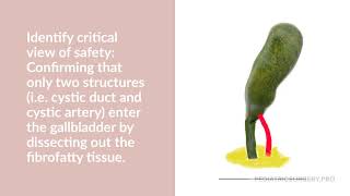 Laparoscopic Cholecystectomy [upl. by Theodora]
