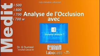 Analyse de locclusion avec quotOcclusion Analyzerquot [upl. by Herwin]